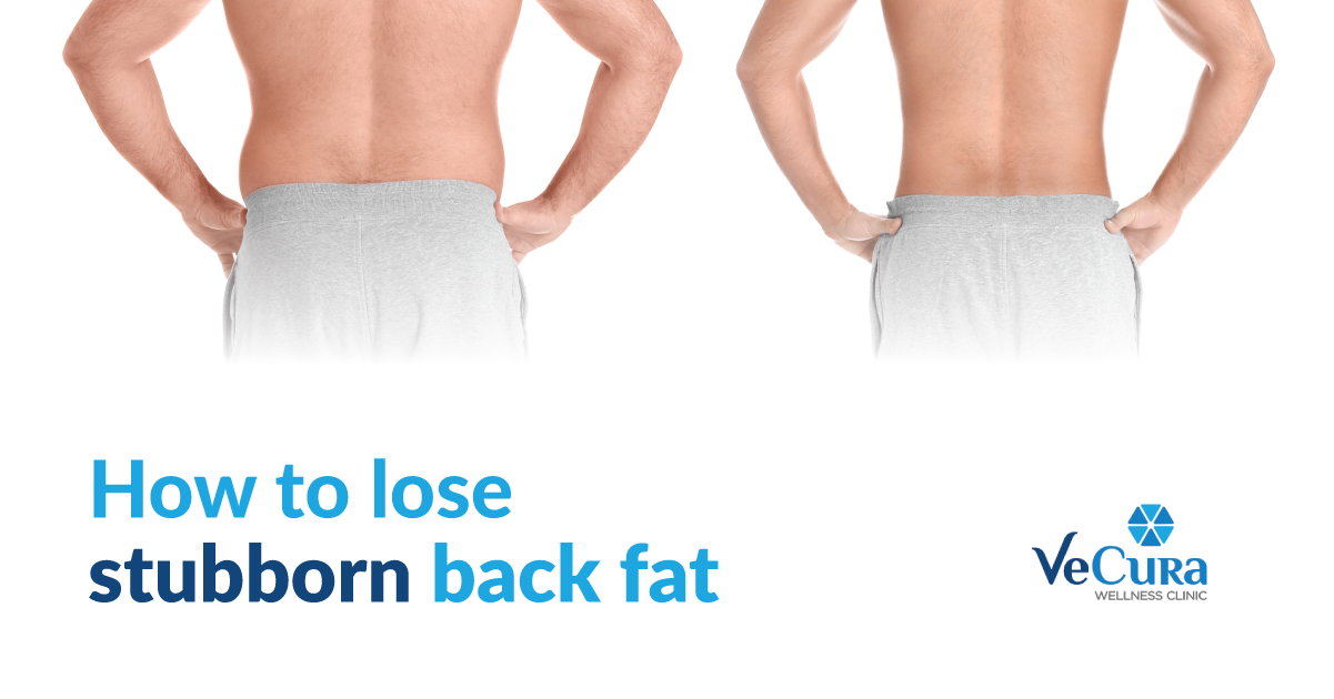 How To Lose Stubborn Back Fat?