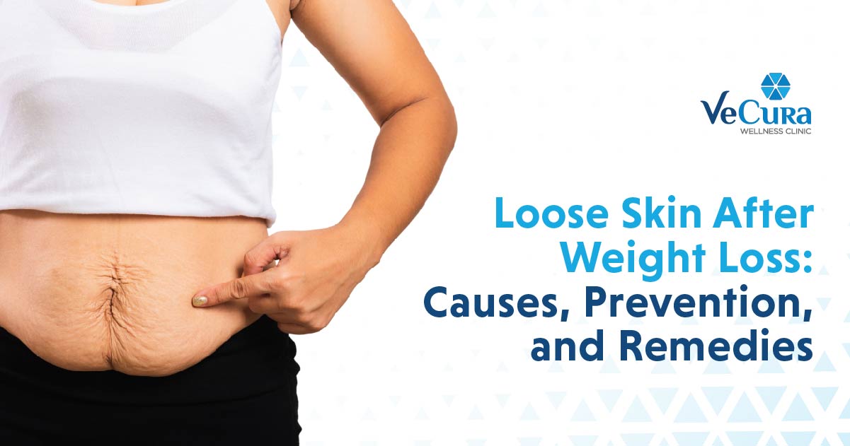 Loose Skin After Weight Loss Causes Prevention And Remedies Vecura 