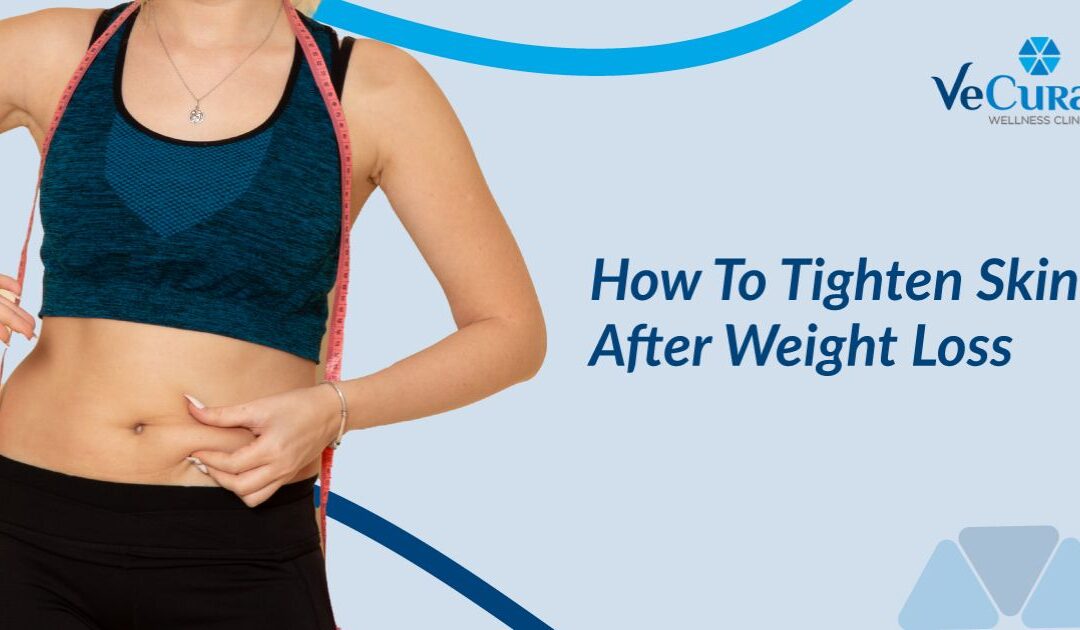 How To Tighten Skin After Weight Loss?