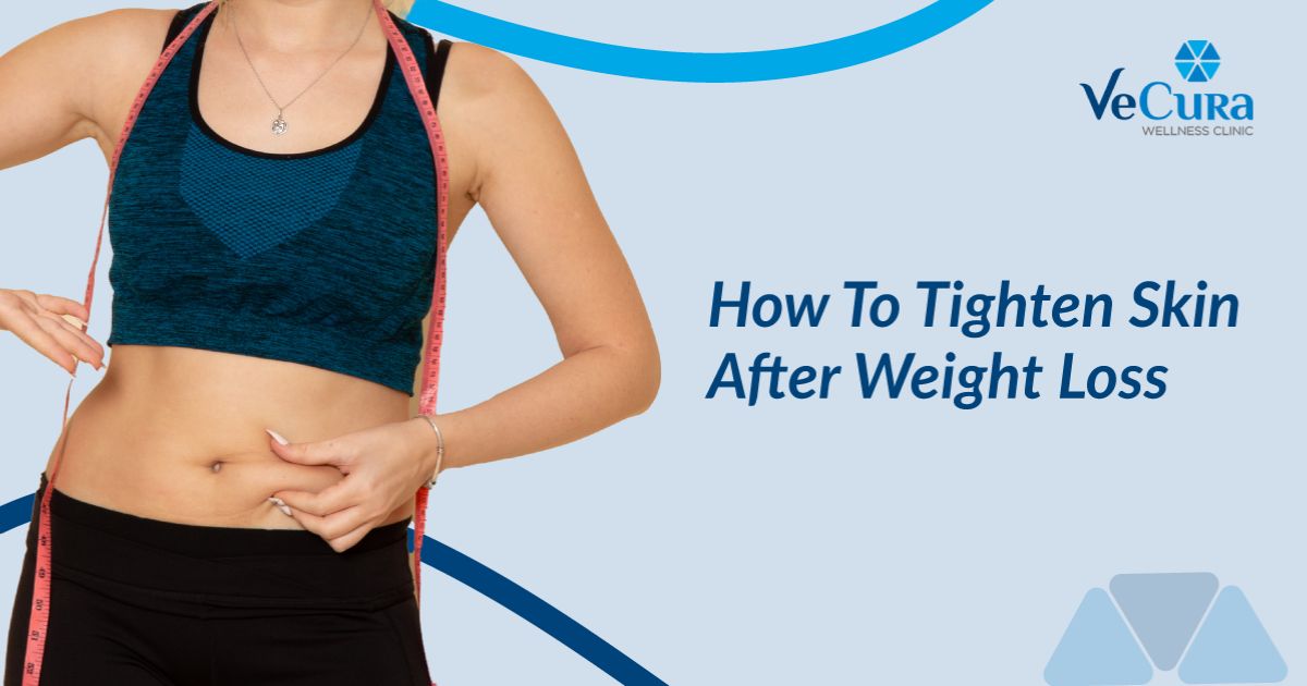 how to tighten skin after weight loss image