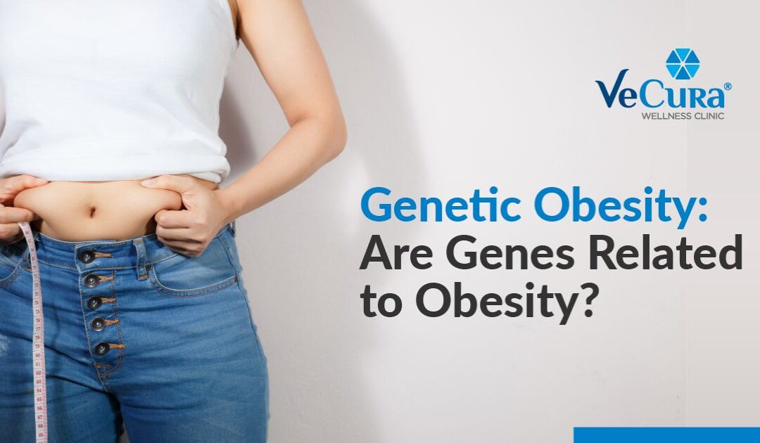 Genetic Obesity: Are Genes Related to Obesity?